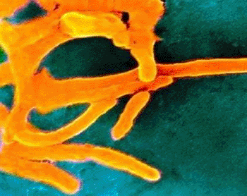 Imagen: La bacteria oral Fusobacterium nucleatum (Fotografía cortesía de HealthyDent).